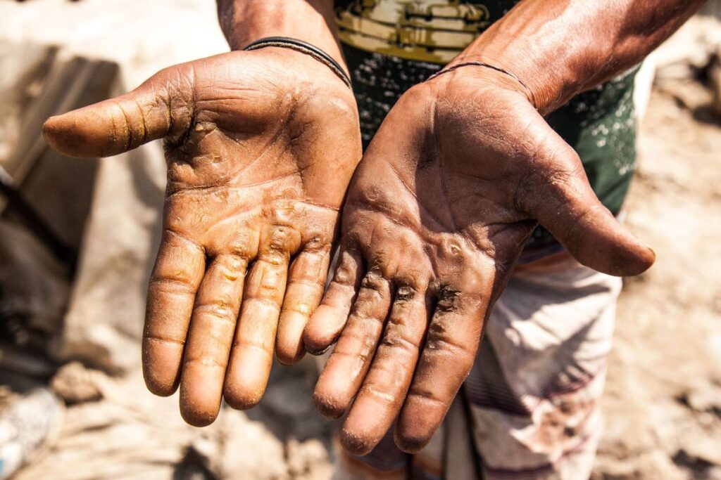 Calloused hands representing discipline and mental toughness in David Goggins quotes